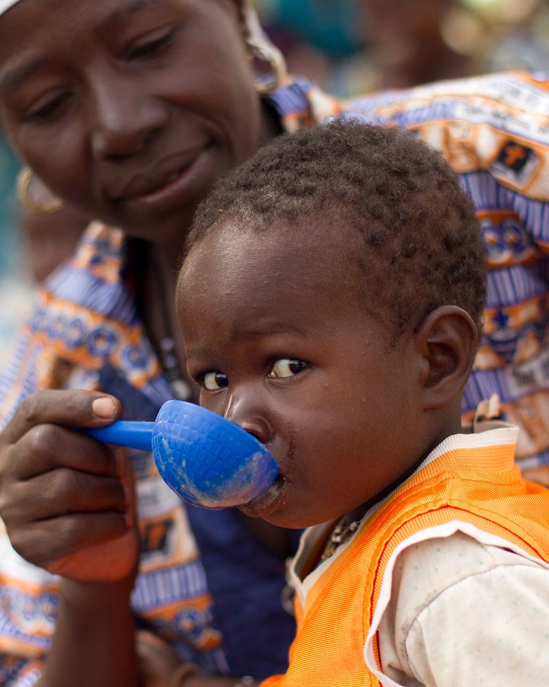 Bambino riceve latte terapeutico per malnutrizione