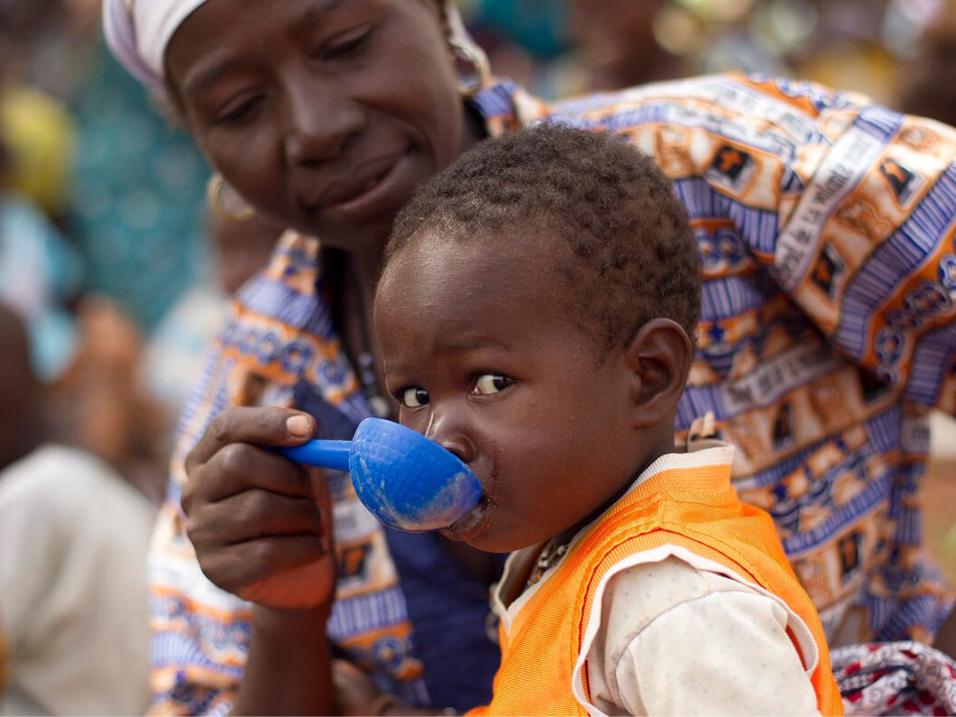 Bambino riceve latte terapeutico per malnutrizione
