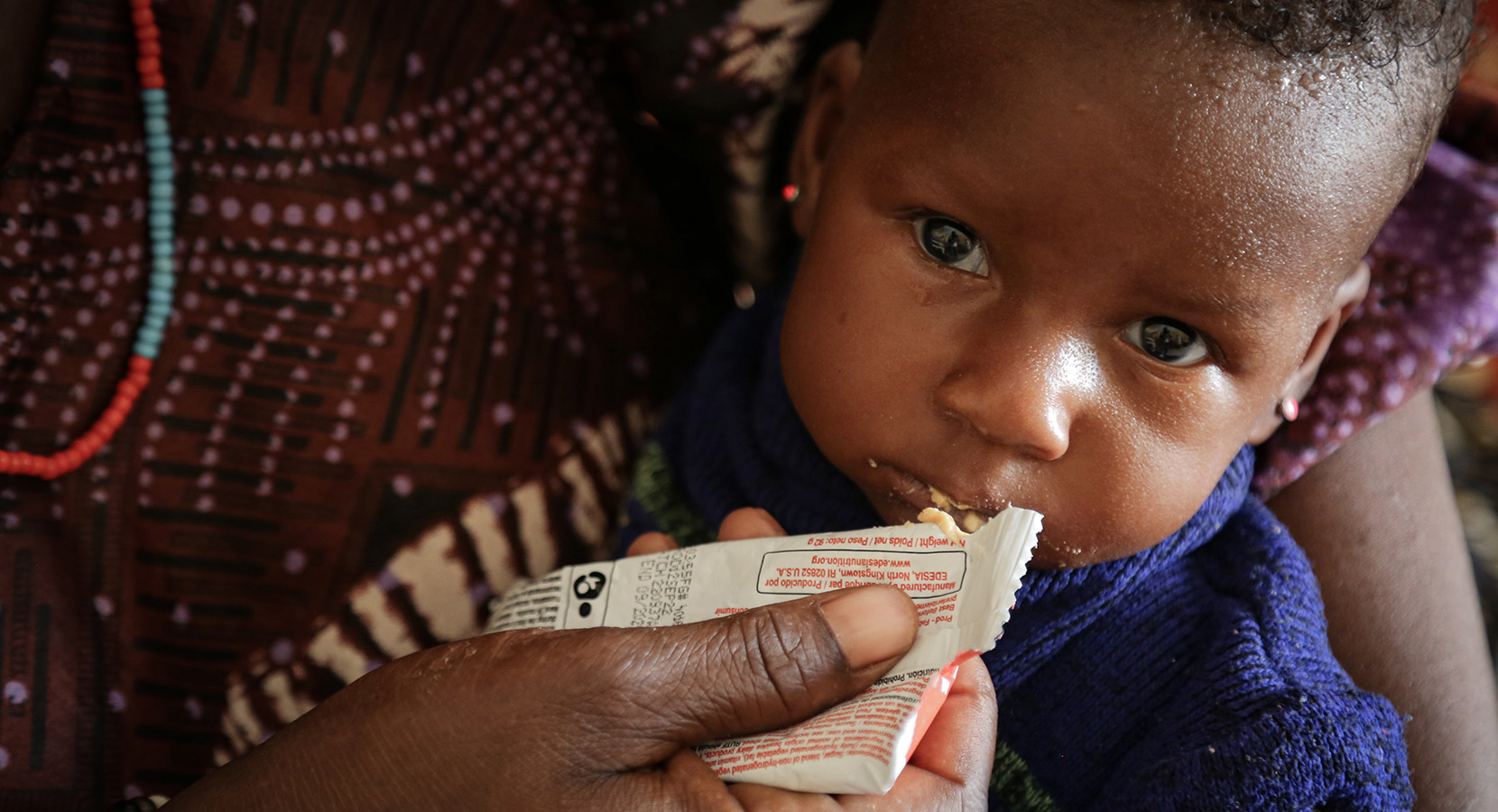 unicef-curiamo-per-salvare-bambini-dalla-malnutrizione